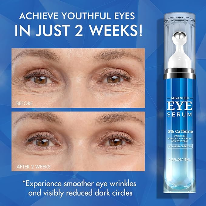 Eye Serum with Caffeine - Caffeine & Retinol Eye Cream for Dark Circles - Under Eye Cream Morning Skincare - Hyaluronic Acid and Niacinamide Eye Cream - Daily Eye Serum for Eyelids Puffiness