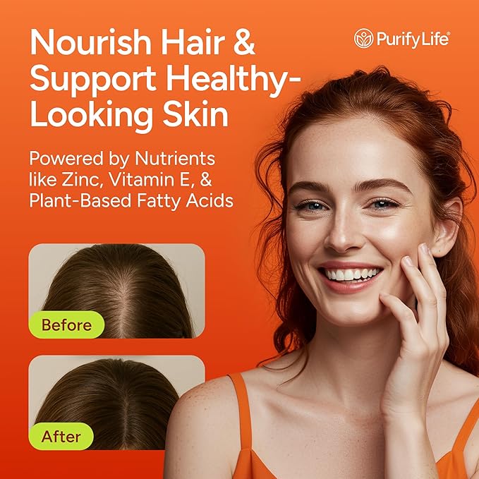 Sugar-Free Pumpkin Seed Oil Gummies (4,000mg/serving) Pumpkin Seed Oil for Hair Growth, Youthful Skin, Prostate Health, Immune & Urinary Tract Support-Natural Source of Essential Fatty Acids-60 Chews
