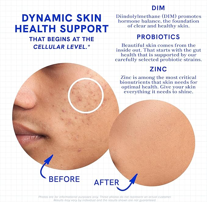 Clear Skin Acne Supplement with Zinc, DIM & Probiotics | 3-in-1 Balance, Clarify, Restore Support with Hyaluronic Acid & Skin Support Vitamins | for Women & Men | Oral Hormonal Acne Pills | 180 Ct